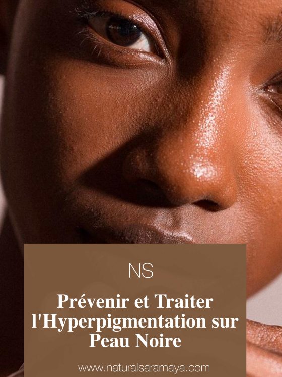 Comment Prévenir et Traiter l’Hyperpigmentation sur Peau Noire